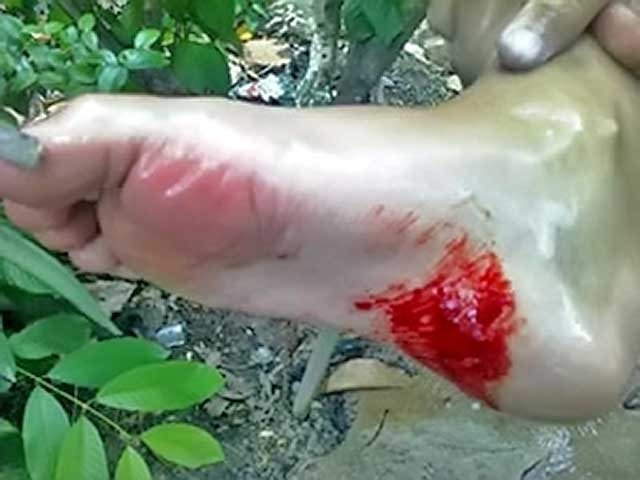 Brazilijos upių paplūdimius užplūdo alkanos piranijos – šios plėšrios žuvys puola poilsiautojus. Brazilijos upių paplūdimius užplūdo alkanos piranijos – šios plėšrios žuvys puola poilsiautojus.